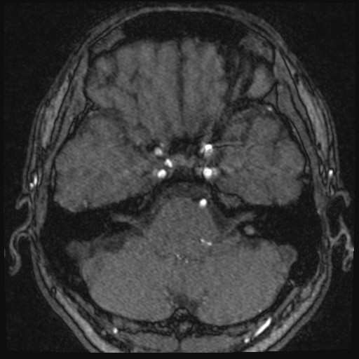 Click on the Serie image to view the images of VILLANUEVA, WILLIAM A.